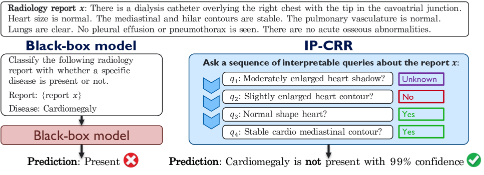 IP-CRR: Information Pursuit for Interpretable Classification of Chest Radiology Reports